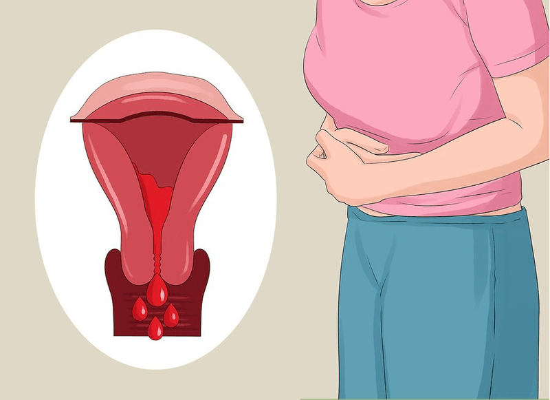 Mơ Thấy Máu Kinh Nguyệt của Mình là Điềm Gì?