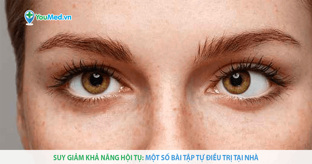 Bệnh Không Phân Biệt Được Màu Sắc Gọi Là Gì? Tìm Hiểu Về Tình Trạng Thường Gặp