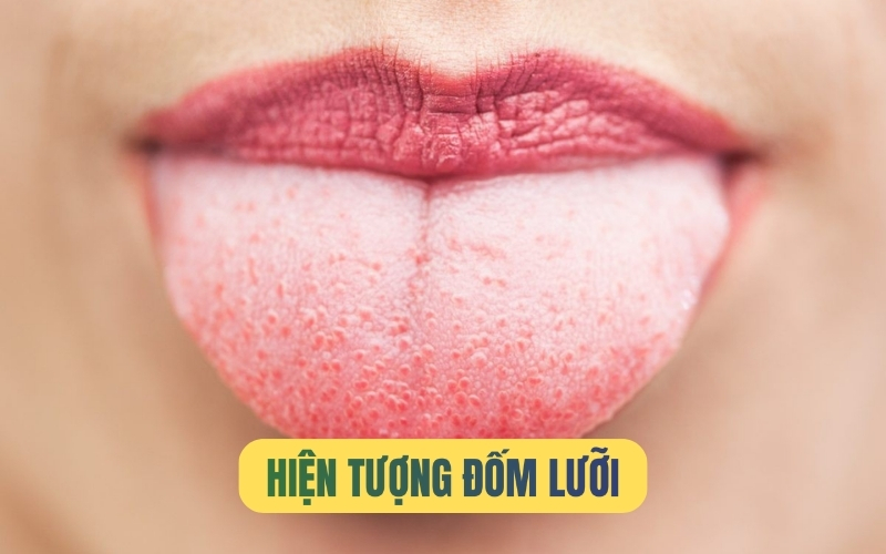 Lưỡi thuộc giác quan nào? Tìm Hiểu Về Vai Trò Của Lưỡi Trong Các Giác Quan